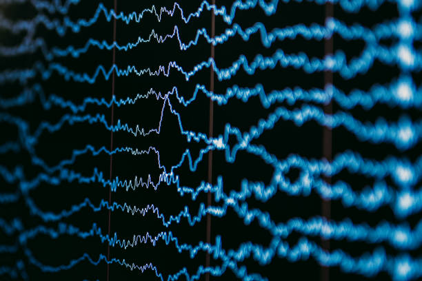 A screen displaying EEG readings