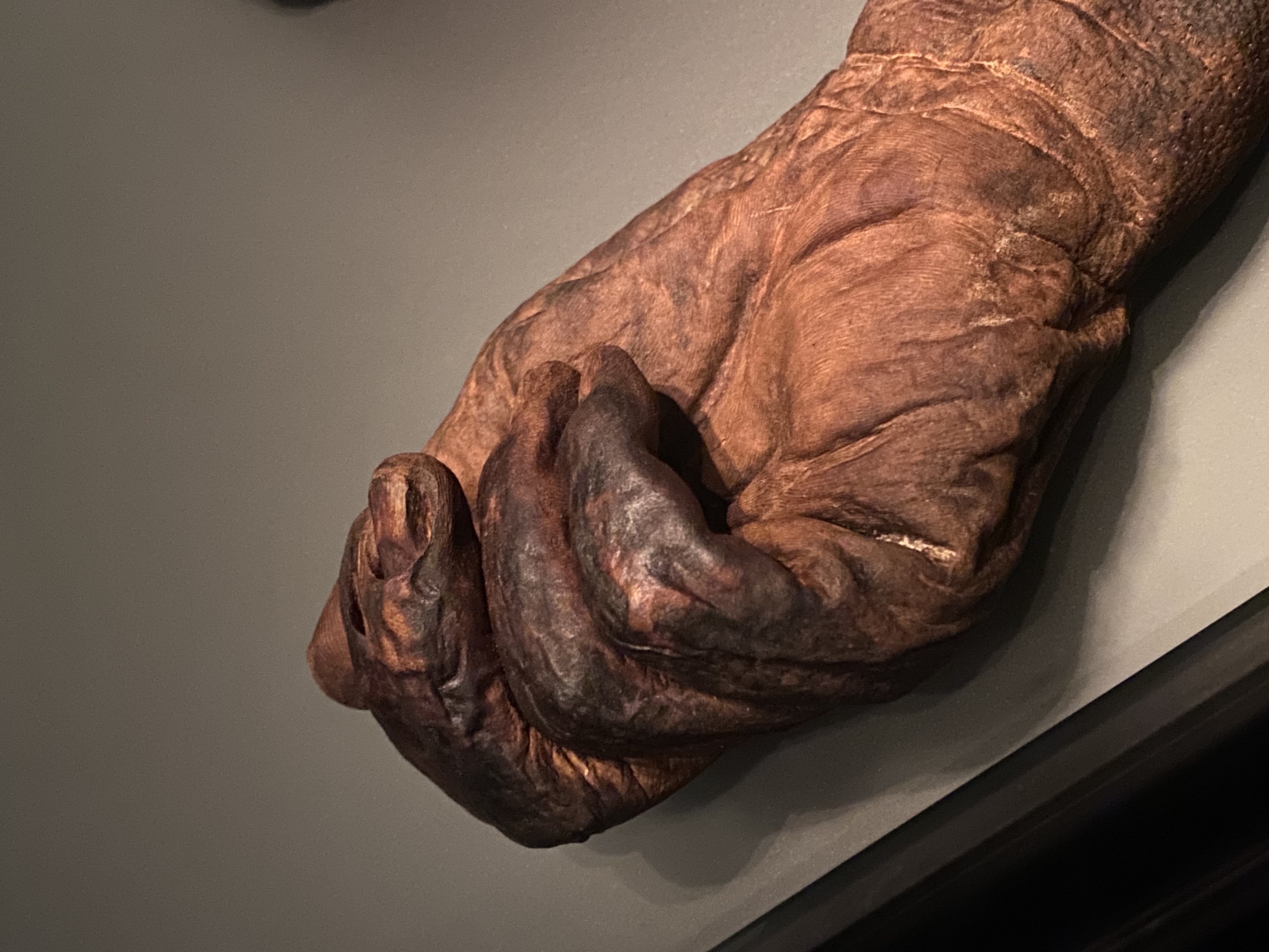 The hand of a deceased human body, preserved by the Bog