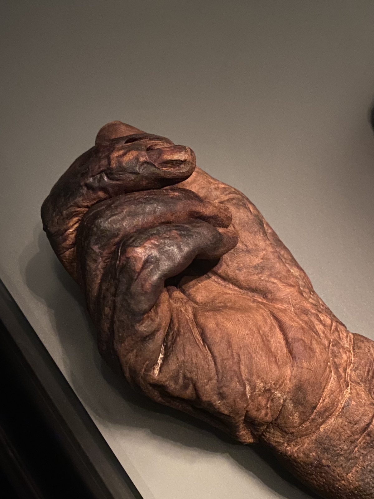 The hand of a deceased human body, preserved by the Bog